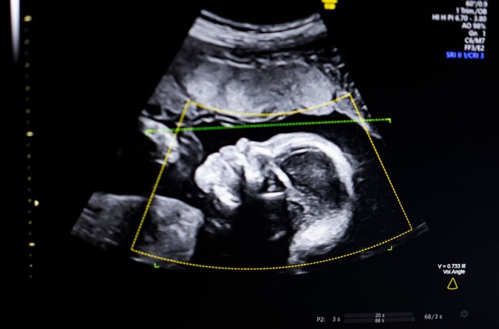 Biotics AI, Battlefield 2023, positive factors FDA approval for its AI-powered fetal ultrasound product 