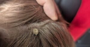 Merritt father warns others after medical emergency involving his younger son – Okanagan