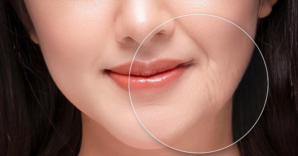 Collagen Sachet Dietary supplements: Why They’re the Finest for Glowing Pores and skin