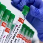 Pakistan registers second mpox-linked loss of life